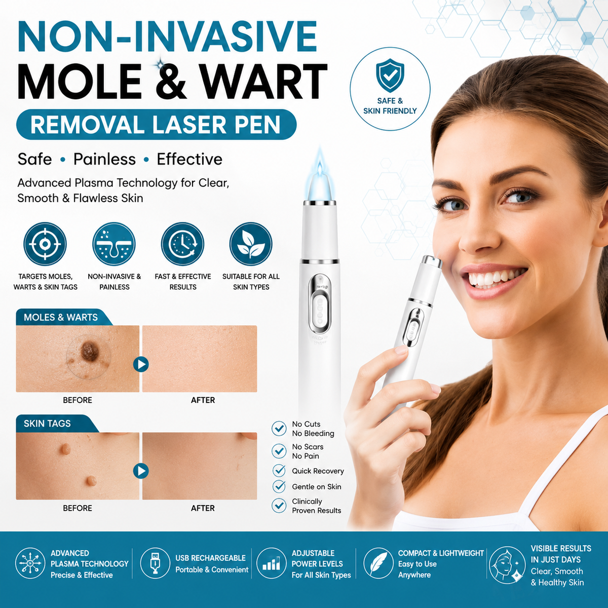 Non-Invasive Mole and Wart Removal Laser Pen
