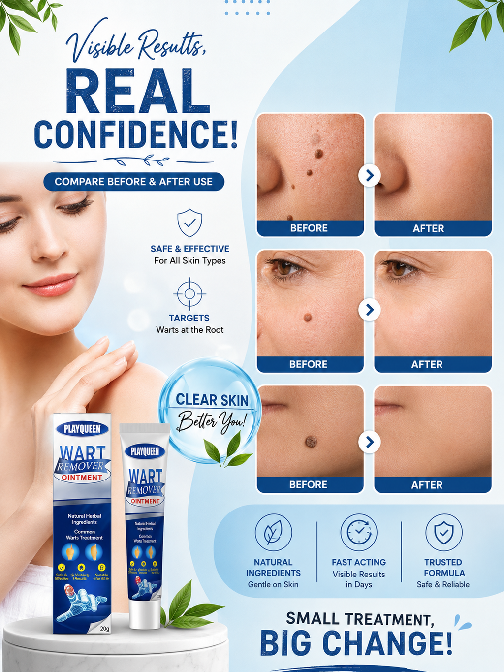 Wart Remover Ointment