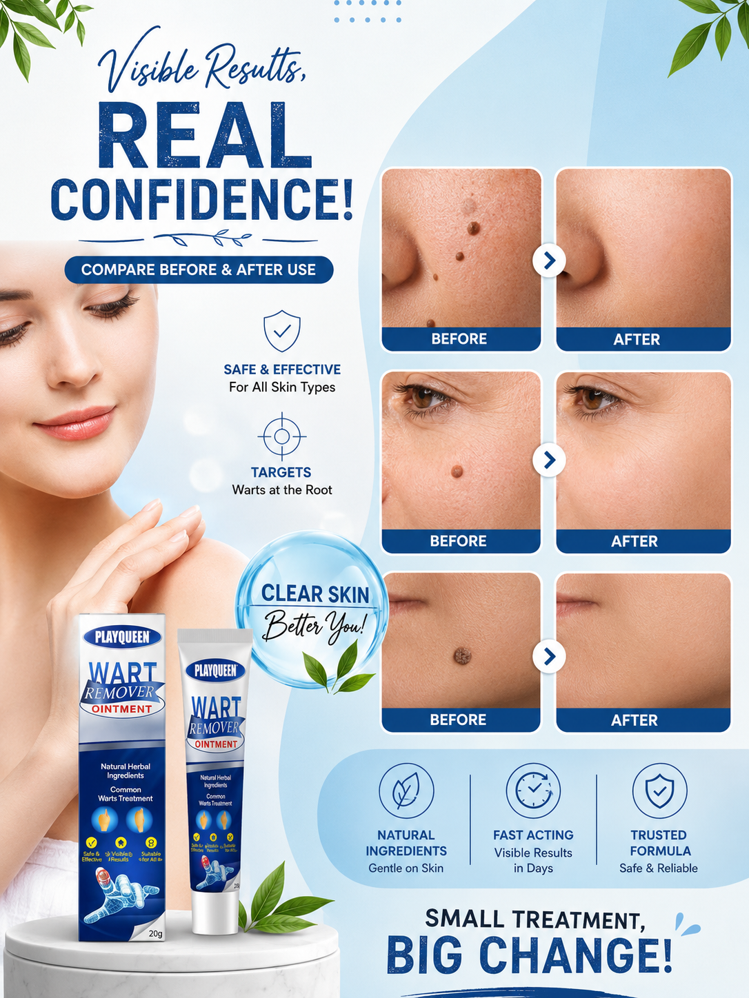 Wart Remover Ointment